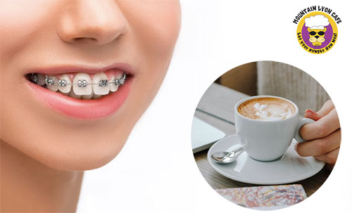 Can You Drink Coffee with Braces